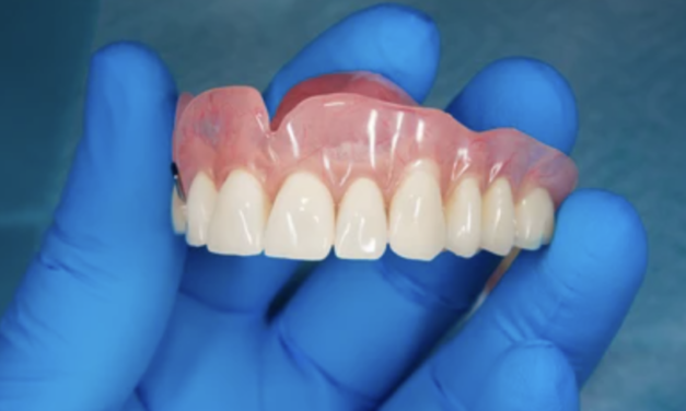 What is an Acrylic Denture?