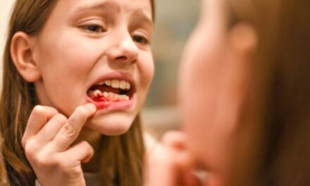 When a Child Has Broken a Tooth