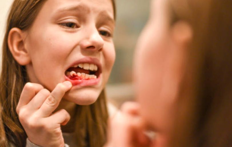 When a Child Has Broken a Tooth